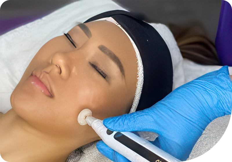 Cold Plasma Therapy being applied during a facial treatment in Orange County, CA